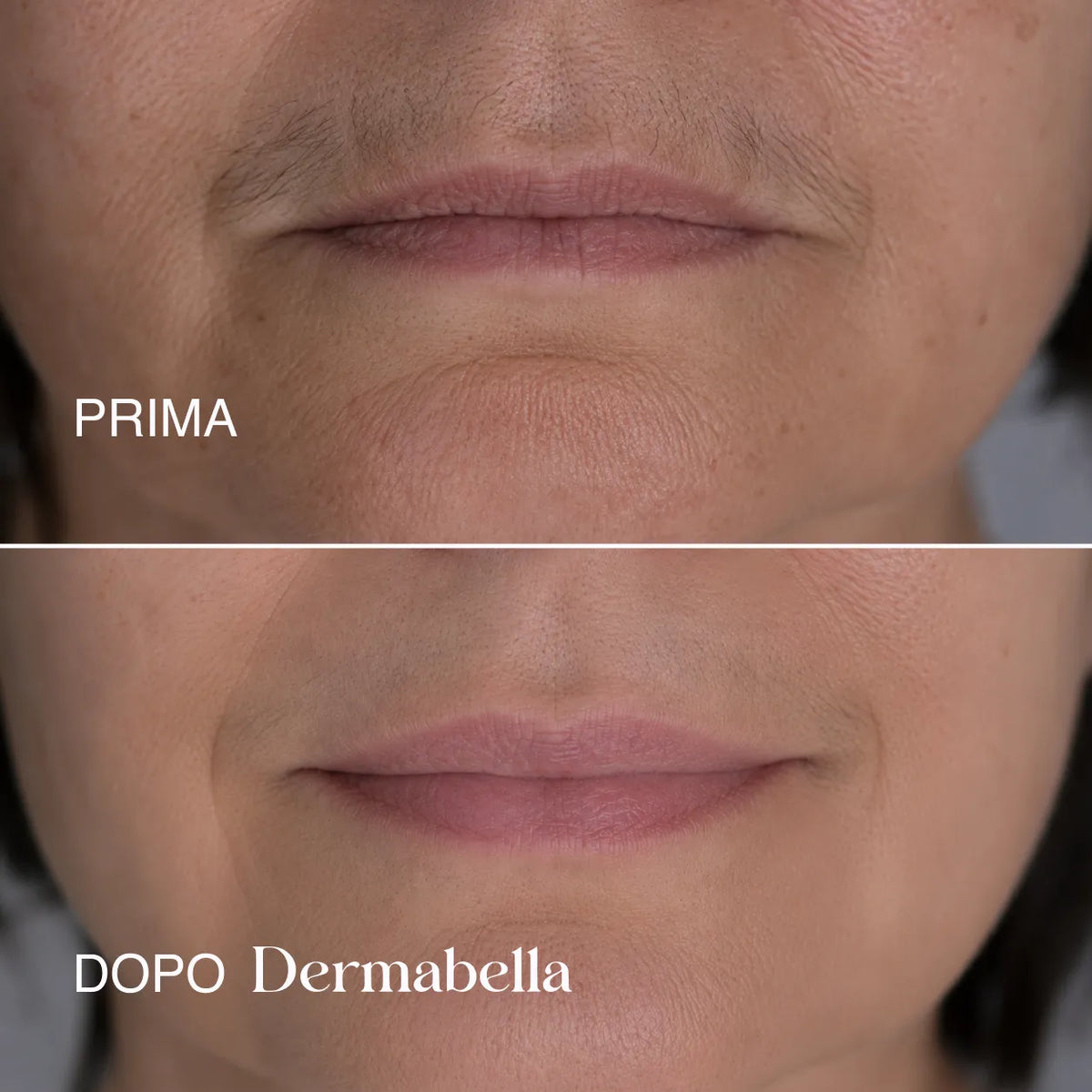Dermabella - Siero Corpo Levigante alla Cyperus Rotundus