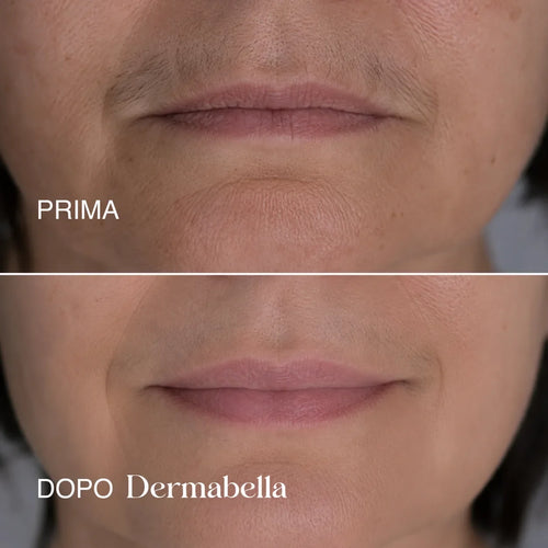 Dermabella - Siero Corpo Levigante alla Cyperus Rotundus