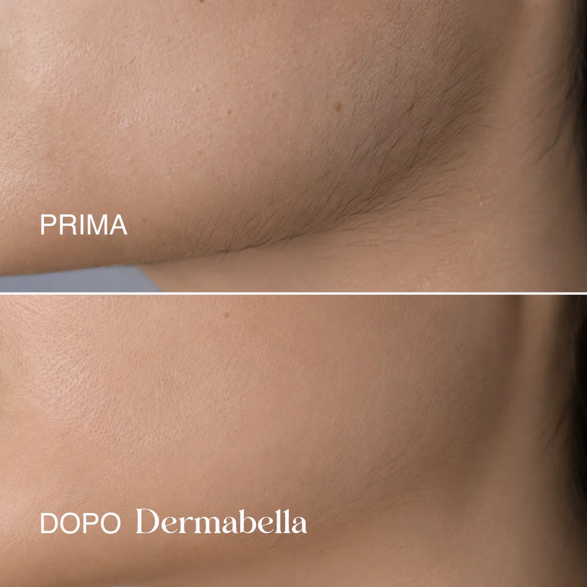 Dermabella - Siero Corpo Levigante alla Cyperus Rotundus